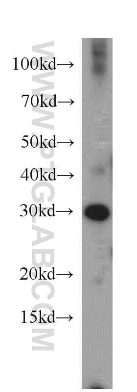 Western Blot (WB) analysis of human skeletal muscle tissue using MRTO4 Polyclonal antibody (20194-1-AP)