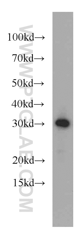 Western Blot (WB) analysis of mouse heart tissue using MRTO4 Polyclonal antibody (20194-1-AP)