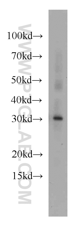 Western Blot (WB) analysis of mouse heart tissue using MRTO4 Polyclonal antibody (20194-1-AP)