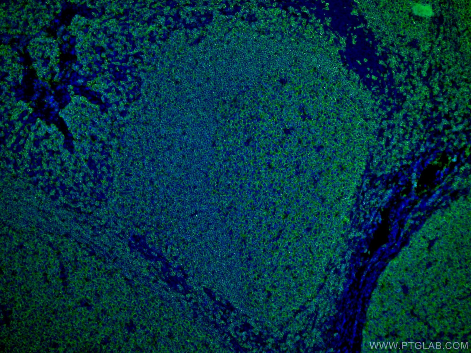 Immunofluorescence (IF) / fluorescent staining of human tonsillitis tissue using CD20 Polyclonal antibody (24828-1-AP)