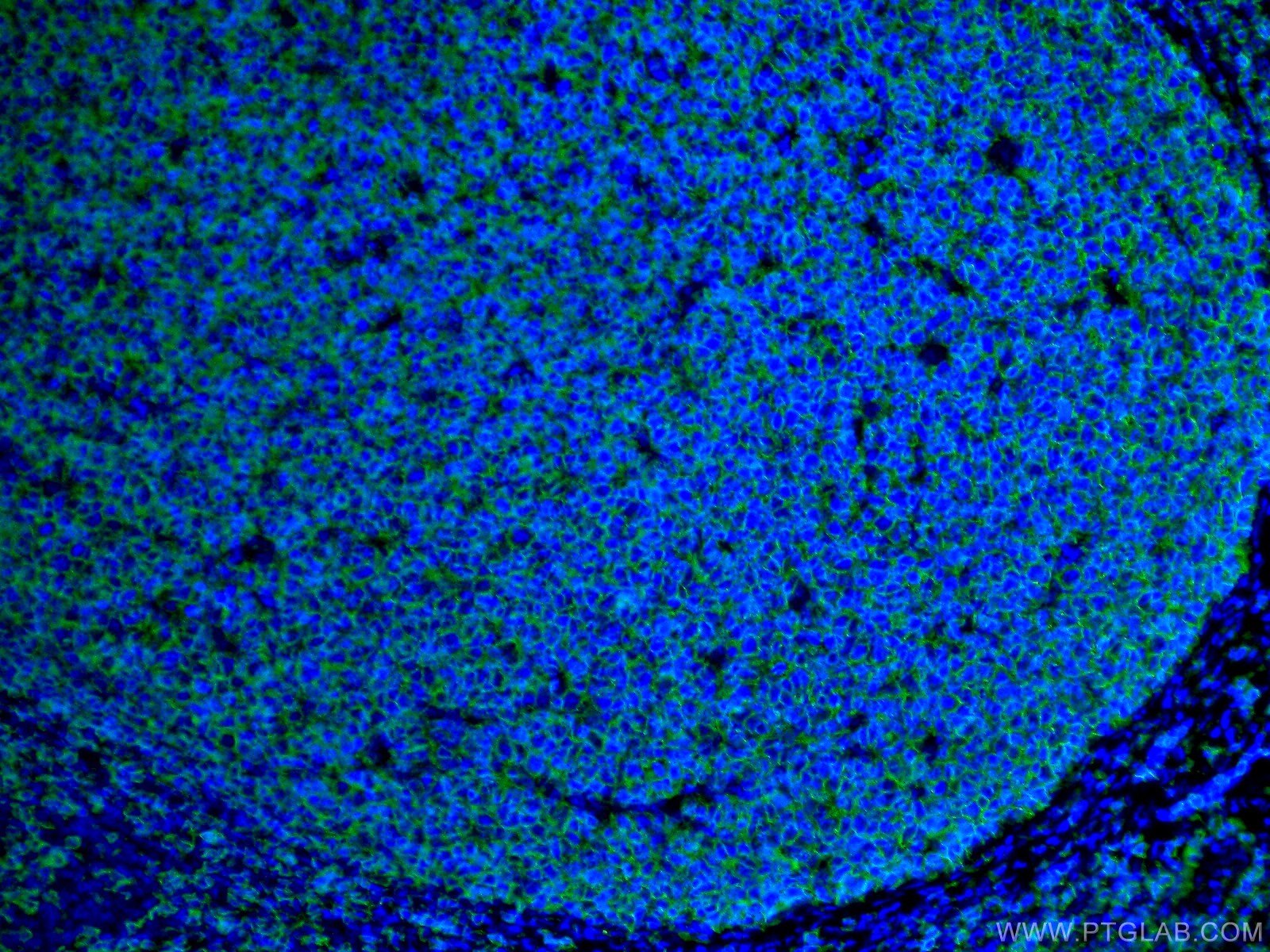 Immunofluorescence (IF) / fluorescent staining of human tonsillitis tissue using CD20 Polyclonal antibody (24828-1-AP)