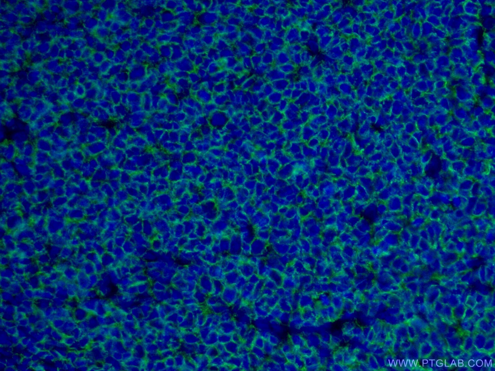 Immunofluorescence (IF) / fluorescent staining of human tonsillitis tissue using CD20 Polyclonal antibody (24828-1-AP)