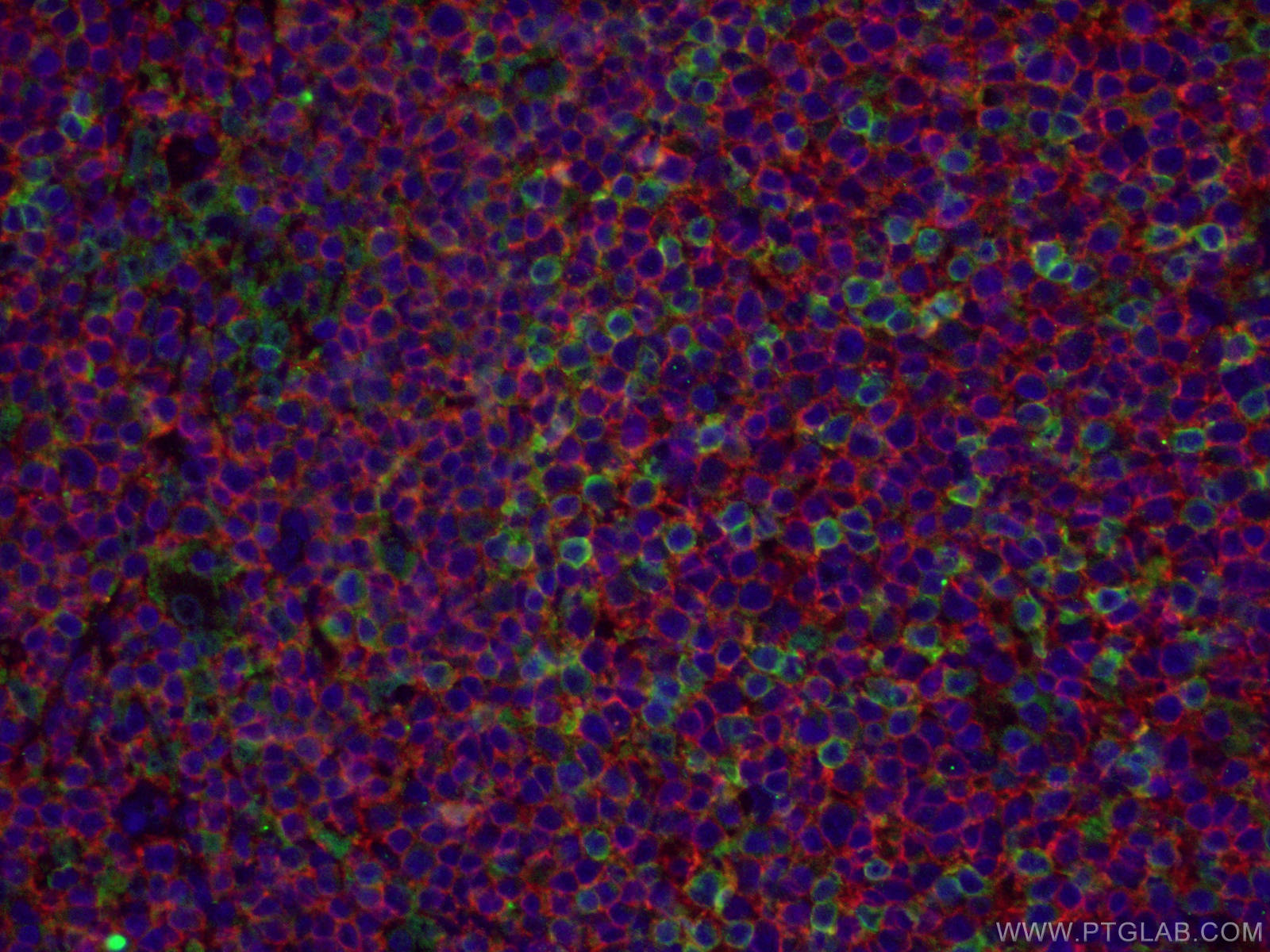 Immunofluorescence (IF) / fluorescent staining of human tonsillitis tissue using CD20 Polyclonal antibody (24828-1-AP)