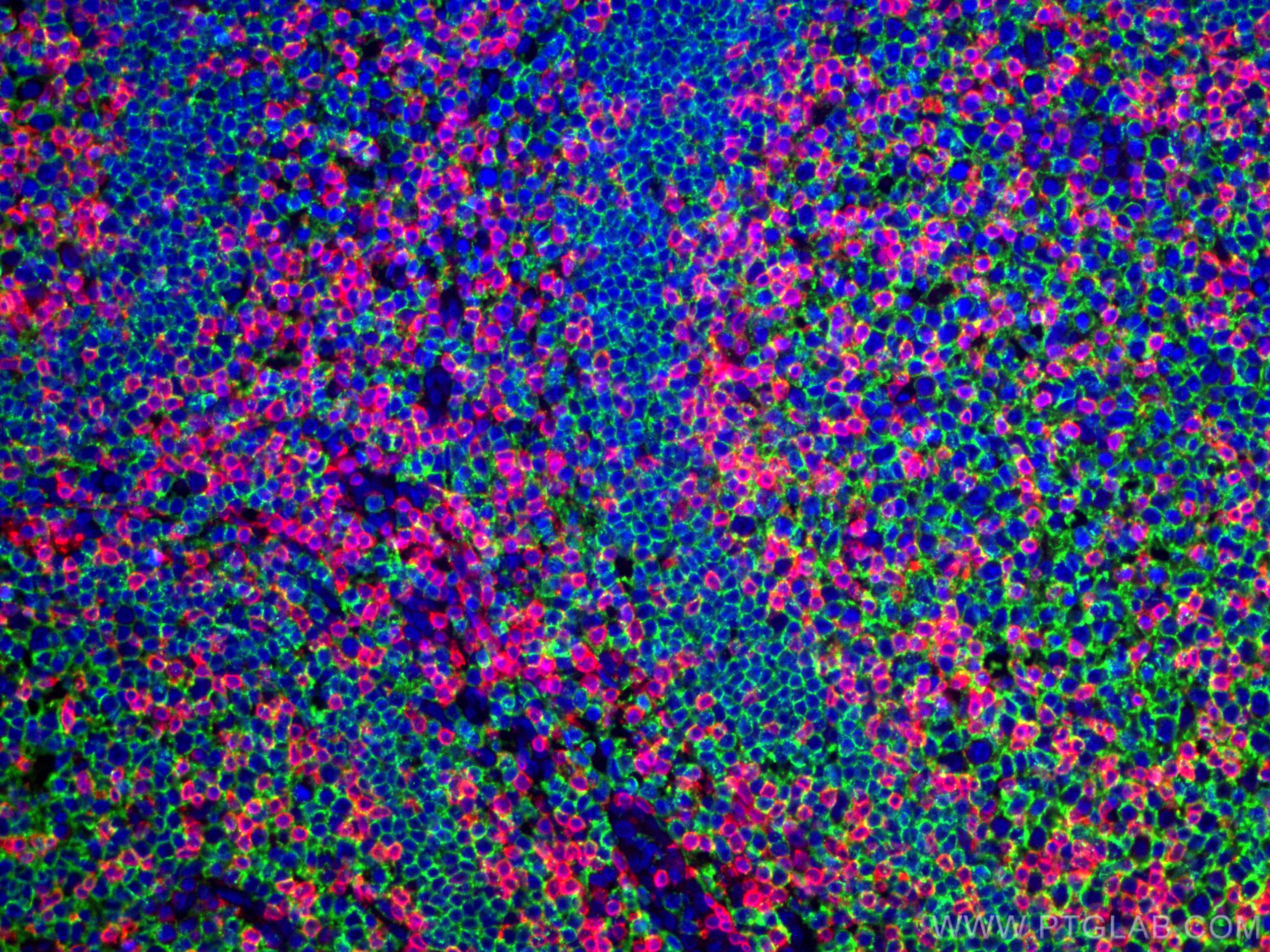 Immunofluorescence (IF) / fluorescent staining of human tonsillitis tissue using CD20 Polyclonal antibody (24828-1-AP)