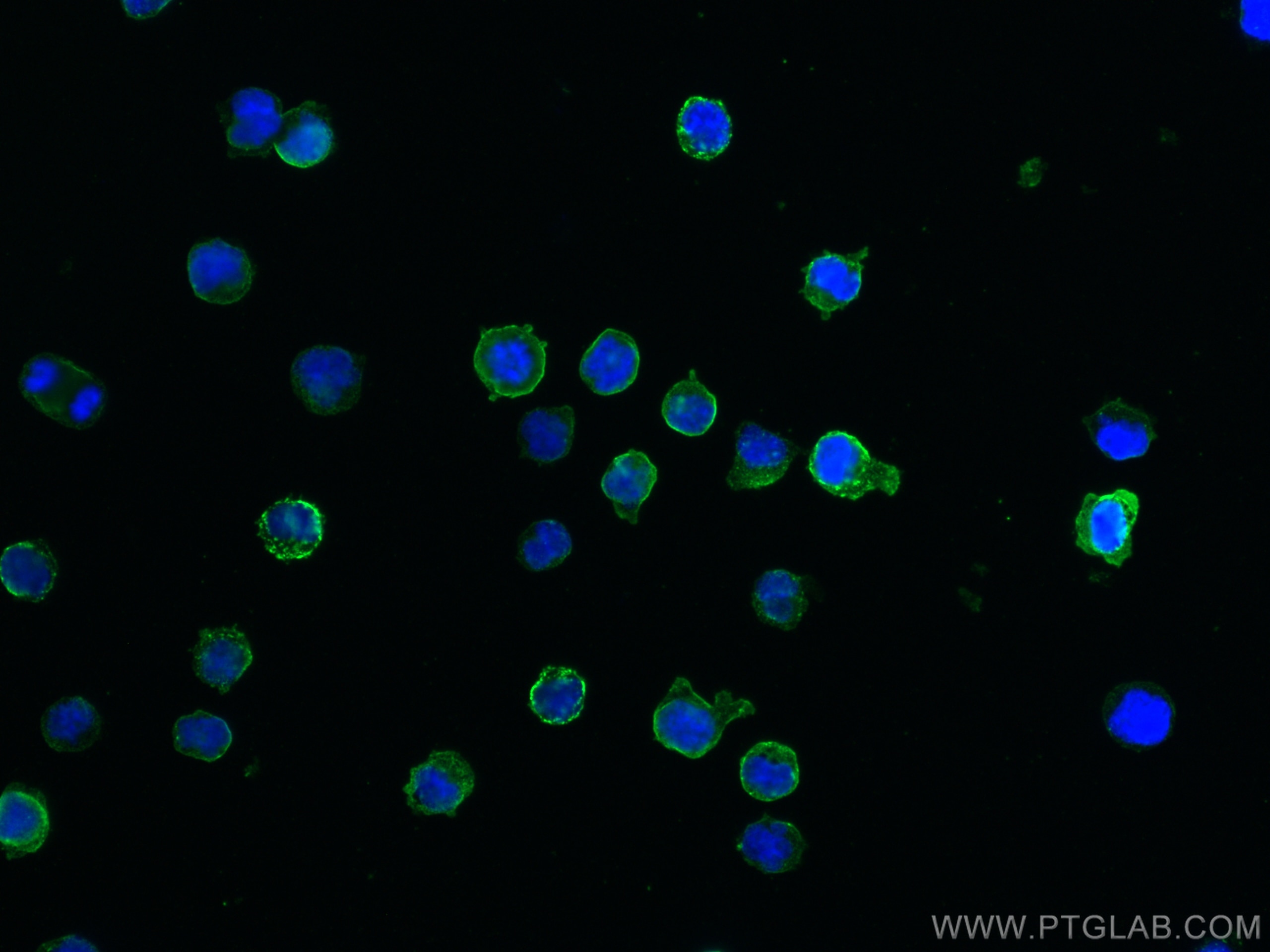 Immunofluorescence (IF) / fluorescent staining of Raji cells using CD20 Polyclonal antibody (24828-1-AP)