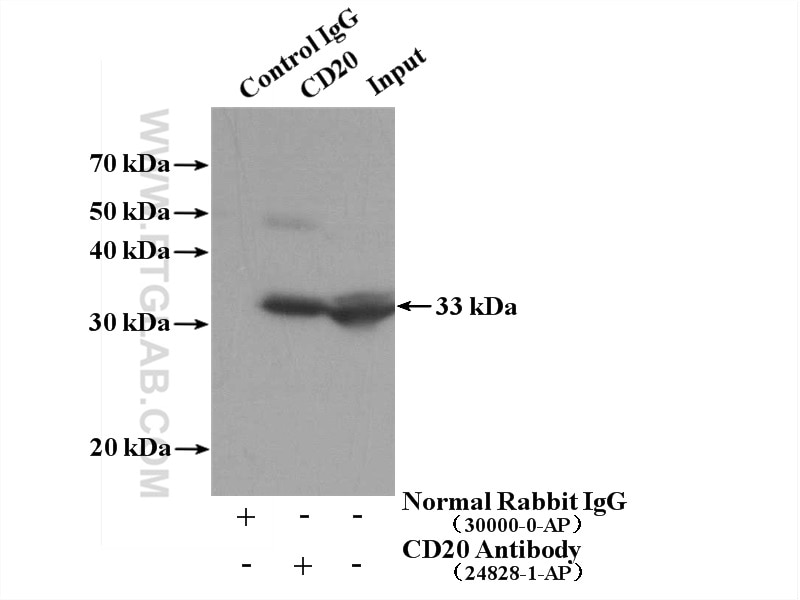 Immunoprecipitation (IP) experiment of Raji cells using CD20 Polyclonal antibody (24828-1-AP)