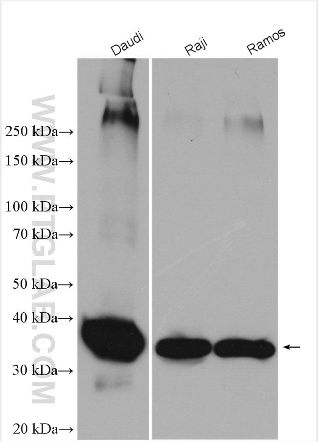 Western Blot (WB) analysis of various lysates using CD20 Polyclonal antibody (24828-1-AP)