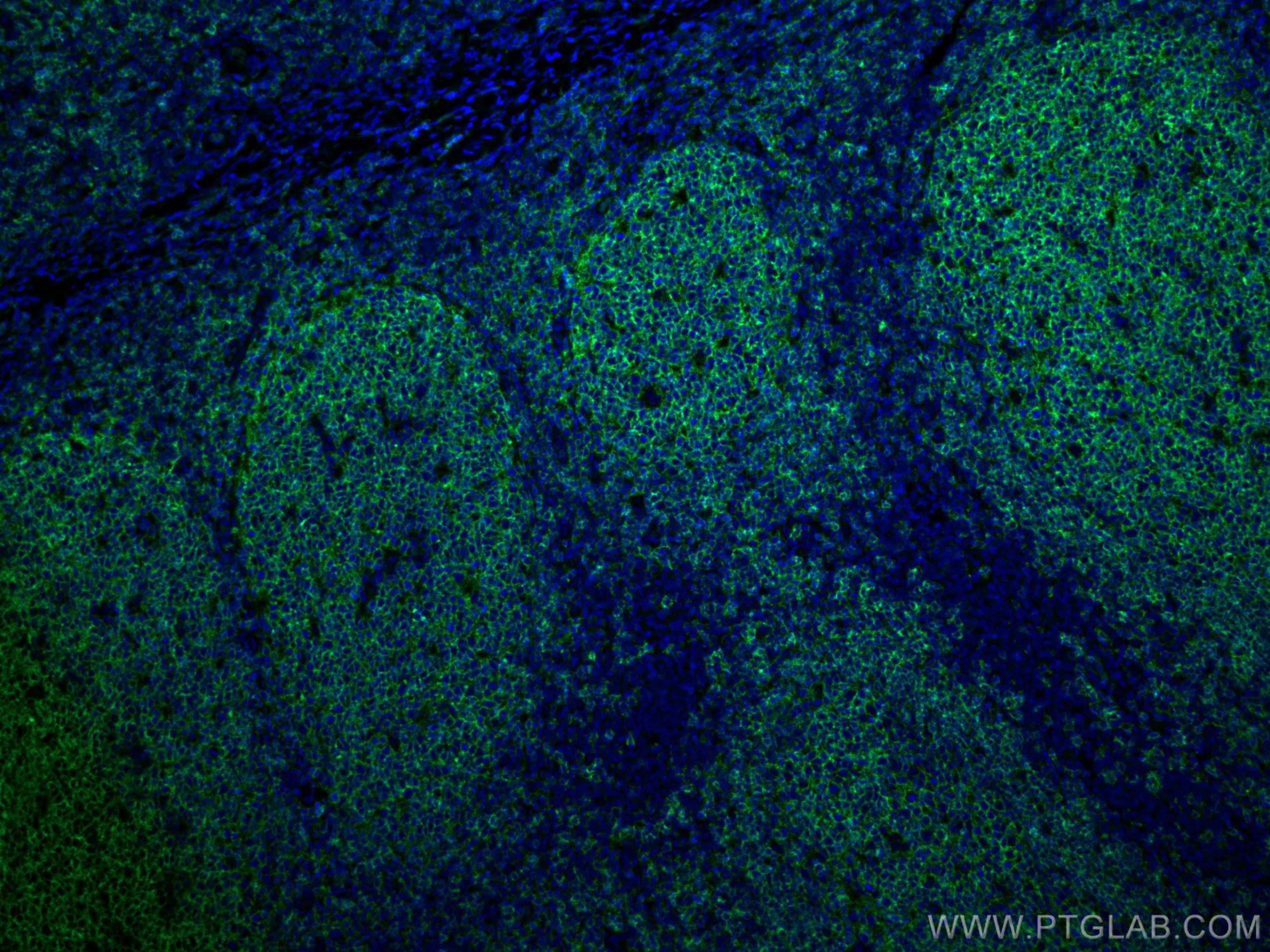 Immunofluorescence (IF) / fluorescent staining of human tonsillitis tissue using CD20 Monoclonal antibody (60271-1-Ig)