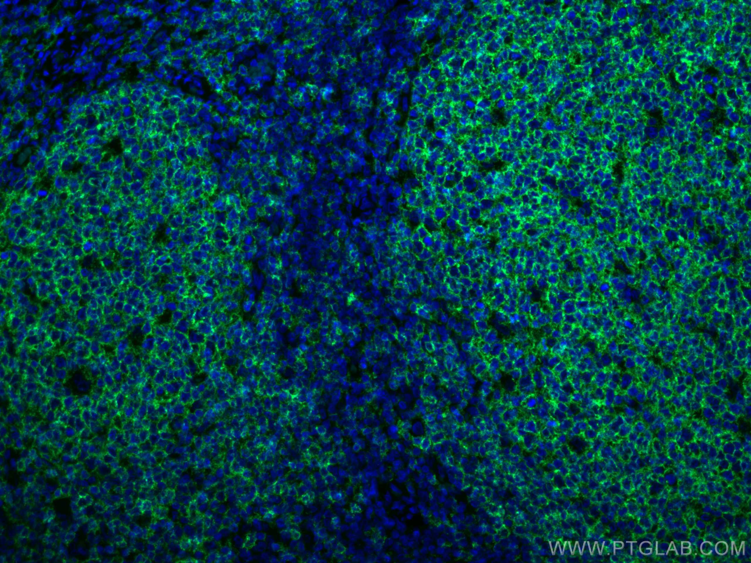 Immunofluorescence (IF) / fluorescent staining of human tonsillitis tissue using CD20 Monoclonal antibody (60271-1-Ig)