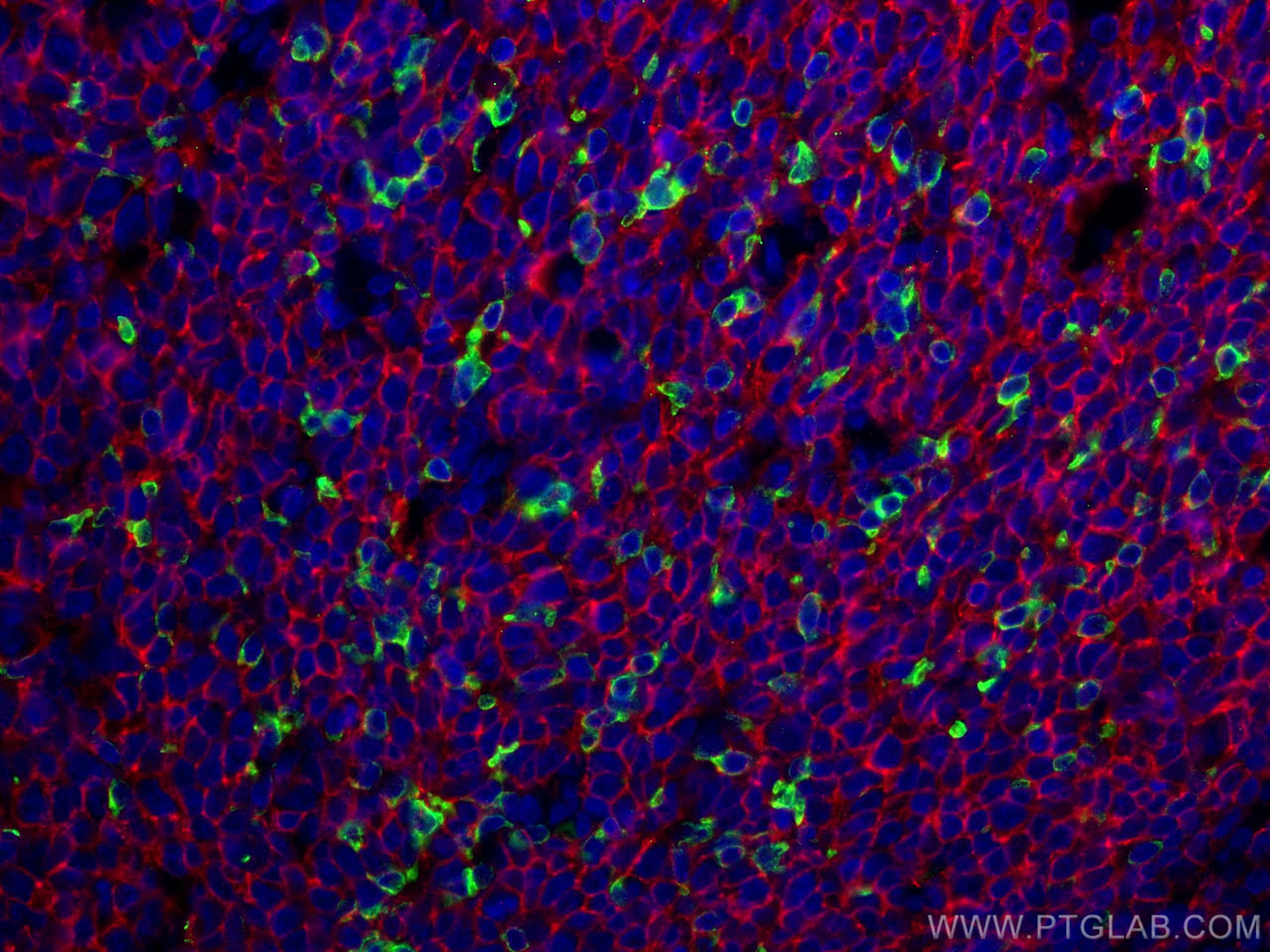 Immunofluorescence (IF) / fluorescent staining of human tonsillitis tissue using CD20 Monoclonal antibody (60271-1-Ig)