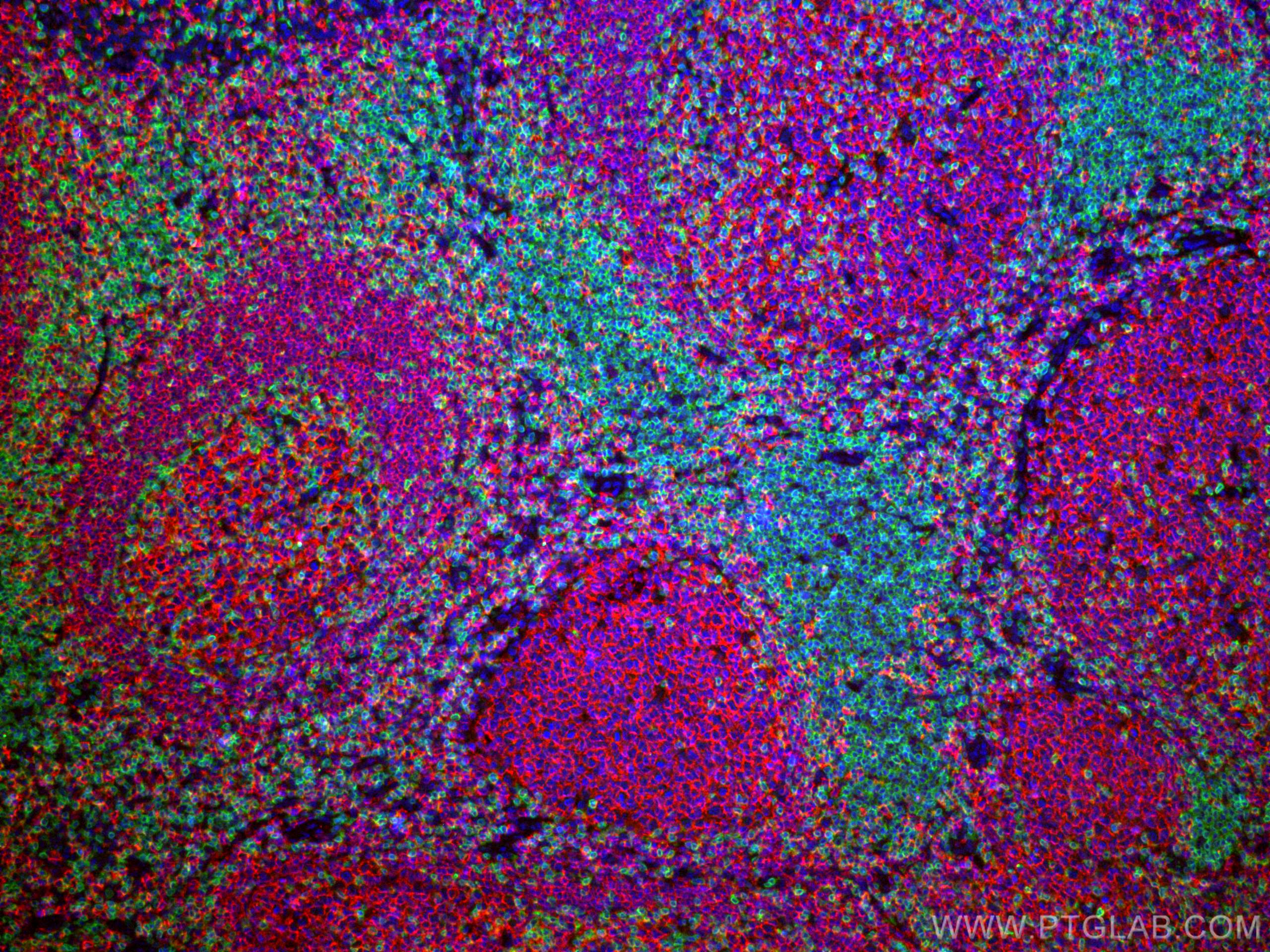 Immunofluorescence (IF) / fluorescent staining of human tonsillitis tissue using CD20 Monoclonal antibody (60271-1-Ig)