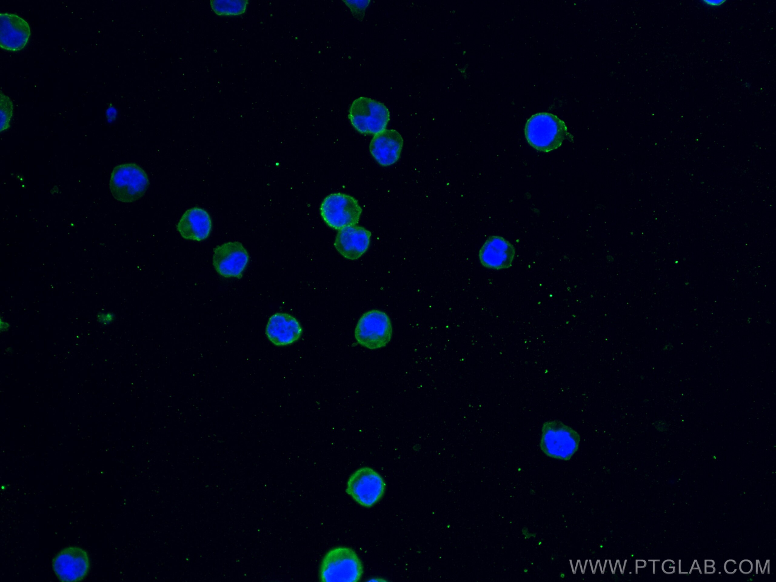 Immunofluorescence (IF) / fluorescent staining of Raji cells using CD20 Monoclonal antibody (60271-1-Ig)