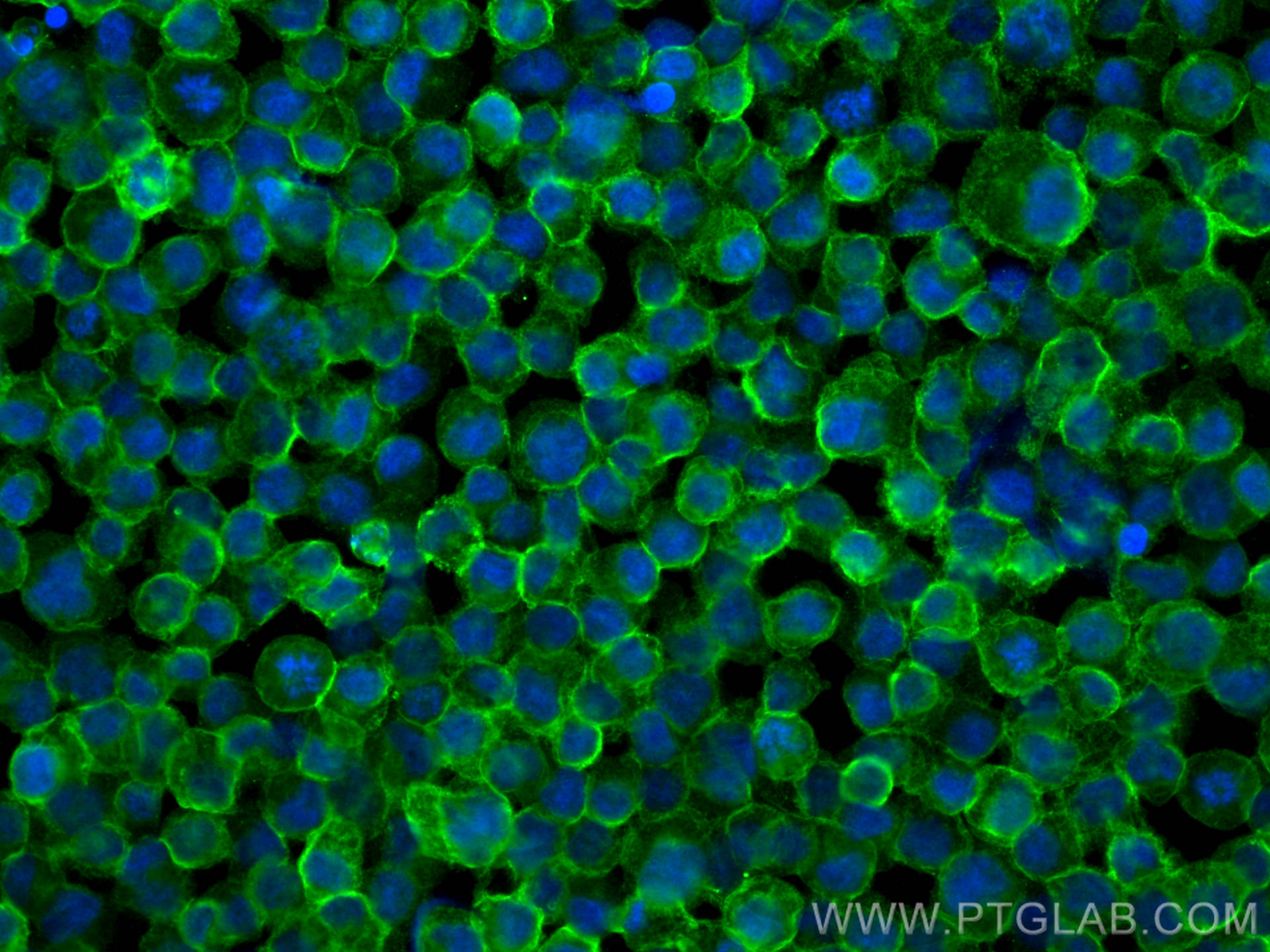 Immunofluorescence (IF) / fluorescent staining of Raji cells using CD20 Monoclonal antibody (60271-1-Ig)
