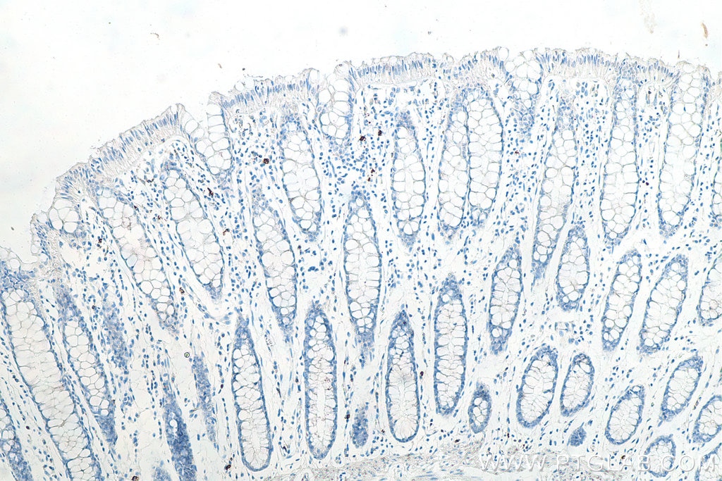 IHC staining of human colon using 60271-1-Ig Immunohistochemistry (IHC) staining of human colon tissue using CD20 Monoclonal antibody (60271-1-Ig)