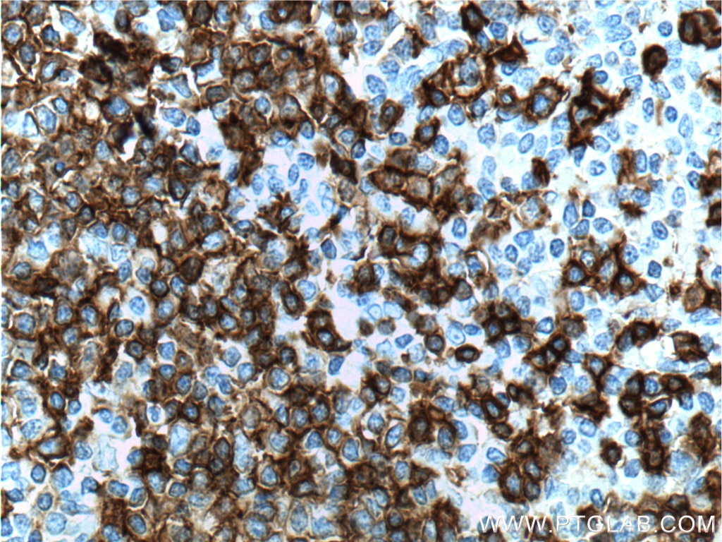 CD20 Monoclonal antibody