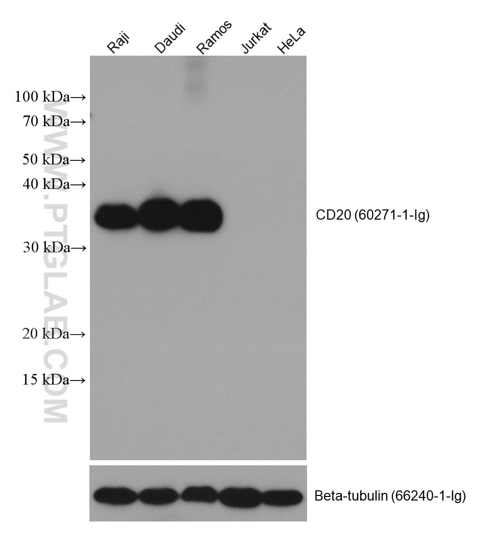 Western Blot (WB) analysis of various lysates using CD20 Monoclonal antibody (60271-1-Ig)