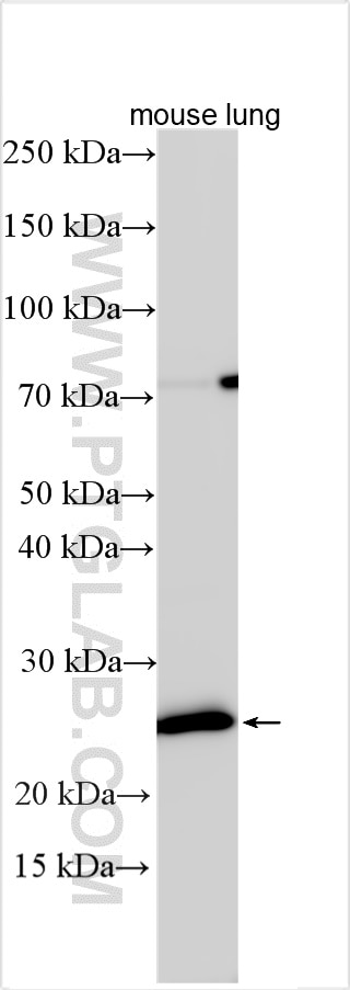 Western Blot (WB) analysis of various lysates using MS4A2 Polyclonal antibody (26808-1-AP)
