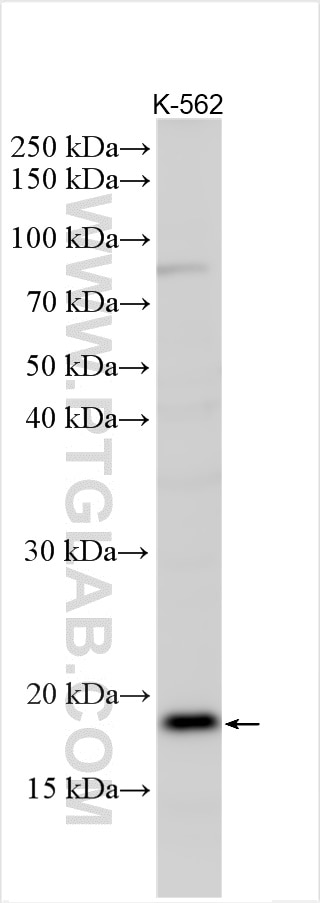 Western Blot (WB) analysis of various lysates using MS4A6A Polyclonal antibody (11930-1-AP)
