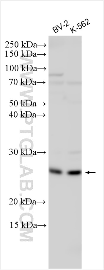 Western Blot (WB) analysis of various lysates using MS4A7 Polyclonal antibody (11864-1-AP)