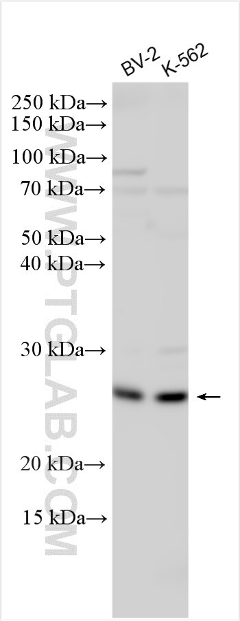 Western Blot (WB) analysis of various lysates using MS4A7 Polyclonal antibody (11864-1-AP)