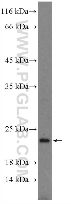 Western Blot (WB) analysis of mouse spleen tissue using MSC Polyclonal antibody (25028-1-AP)