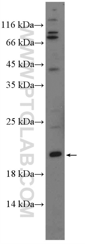 Western Blot (WB) analysis of mouse thymus tissue using MSC Polyclonal antibody (25028-1-AP)