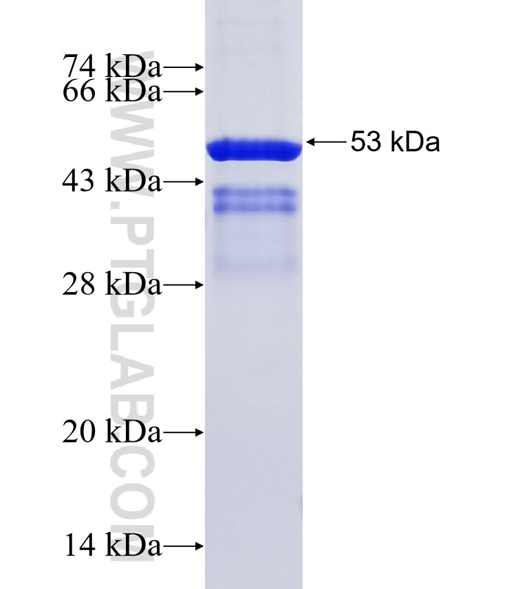 MSC fusion protein Ag13489 SDS-PAGE