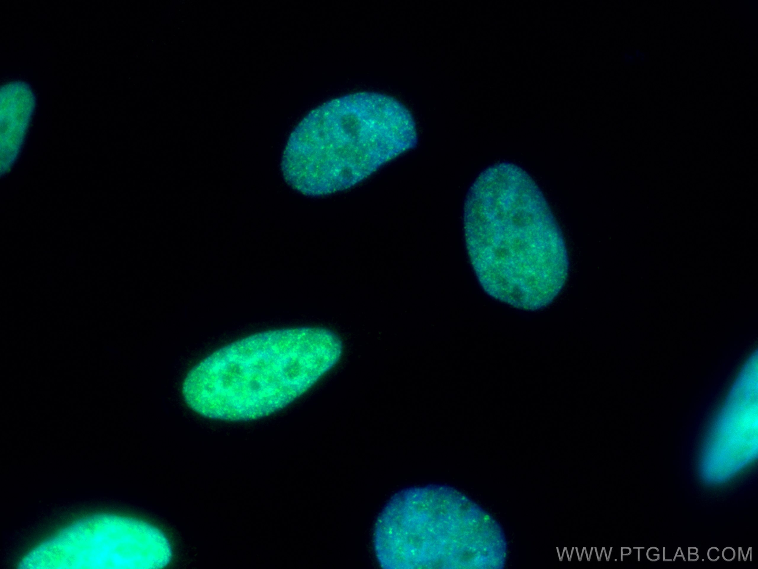 Immunofluorescence (IF) / fluorescent staining of HeLa cells using MSH2 Polyclonal antibody (15520-1-AP)