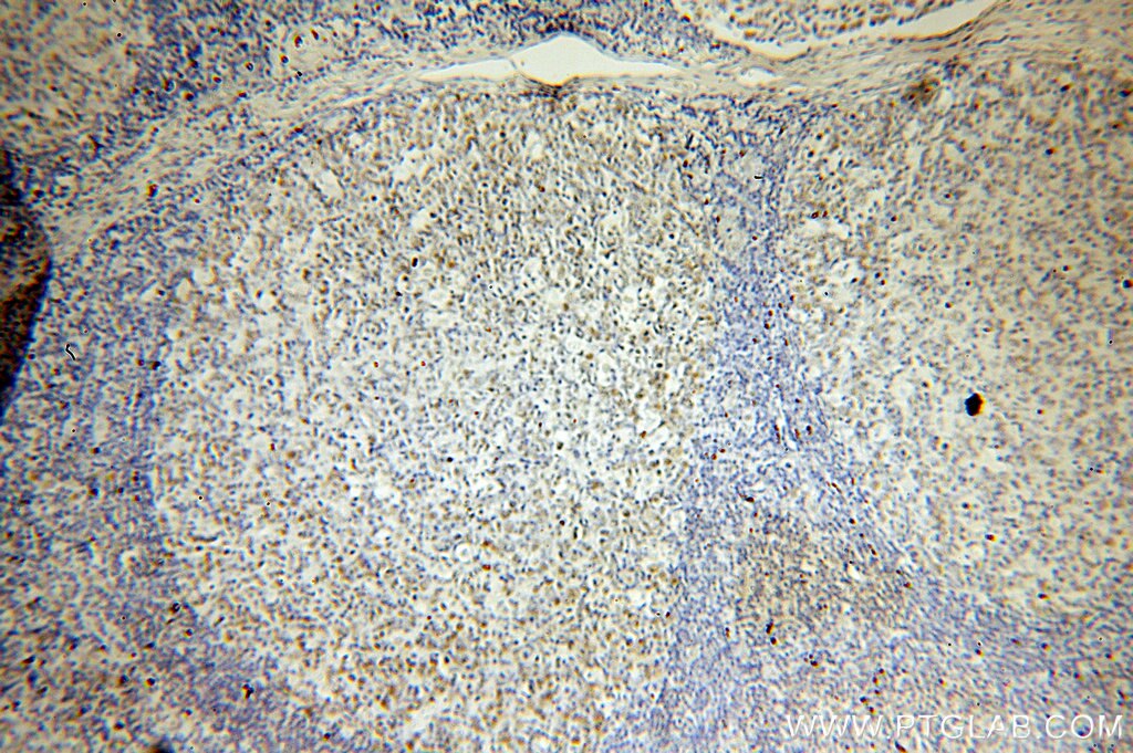 IHC staining of human tonsil using 15520-1-AP