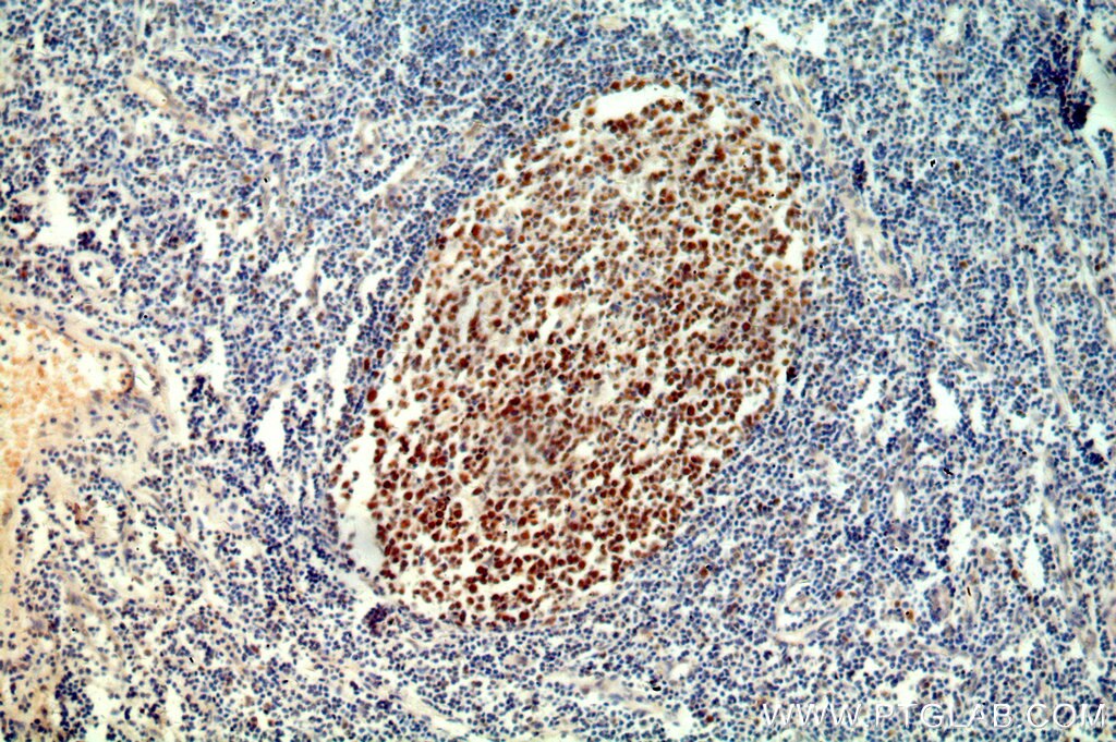 IHC staining of human tonsil using 15520-1-AP