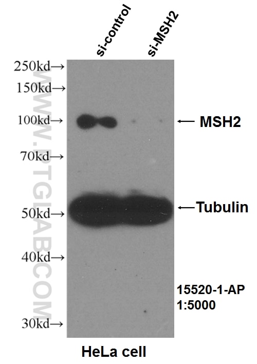 Western Blot (WB) analysis of HeLa cells using MSH2 Polyclonal antibody (15520-1-AP)