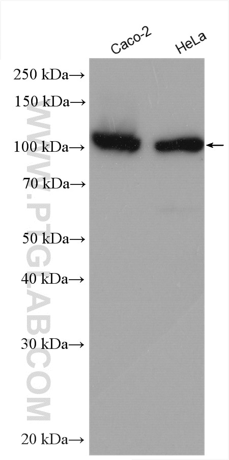 Western Blot (WB) analysis of various lysates using MSH2 Polyclonal antibody (15520-1-AP)