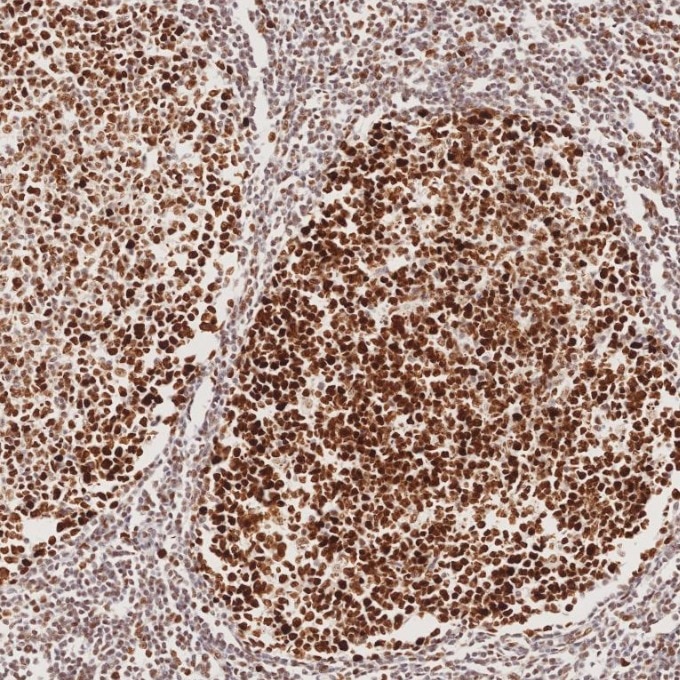 Immunohistochemistry (IHC) staining of human tonsillitis tissue using MSH2 Recombinant monoclonal antibody (82775-1-RR)