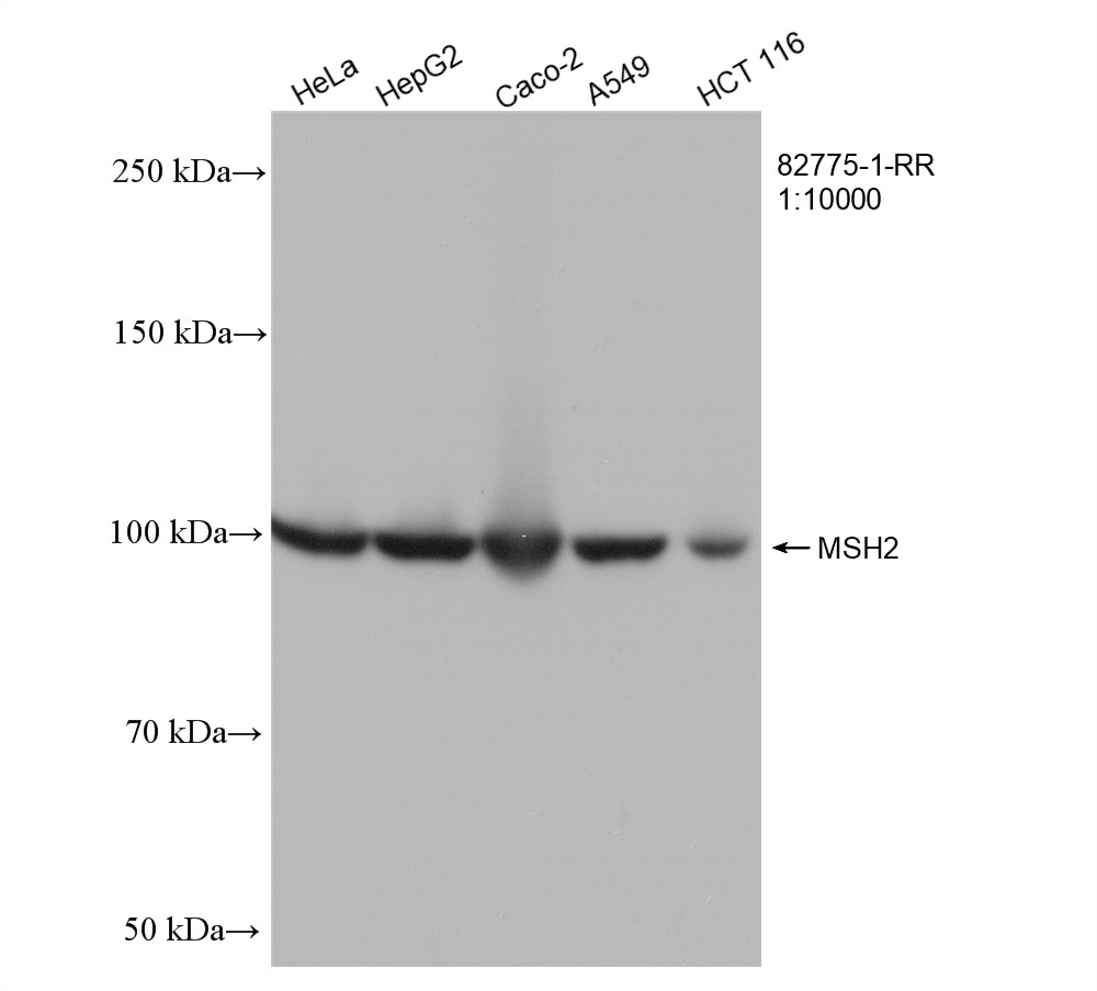 Western Blot (WB) analysis of various lysates using MSH2 Recombinant antibody (82775-1-RR)