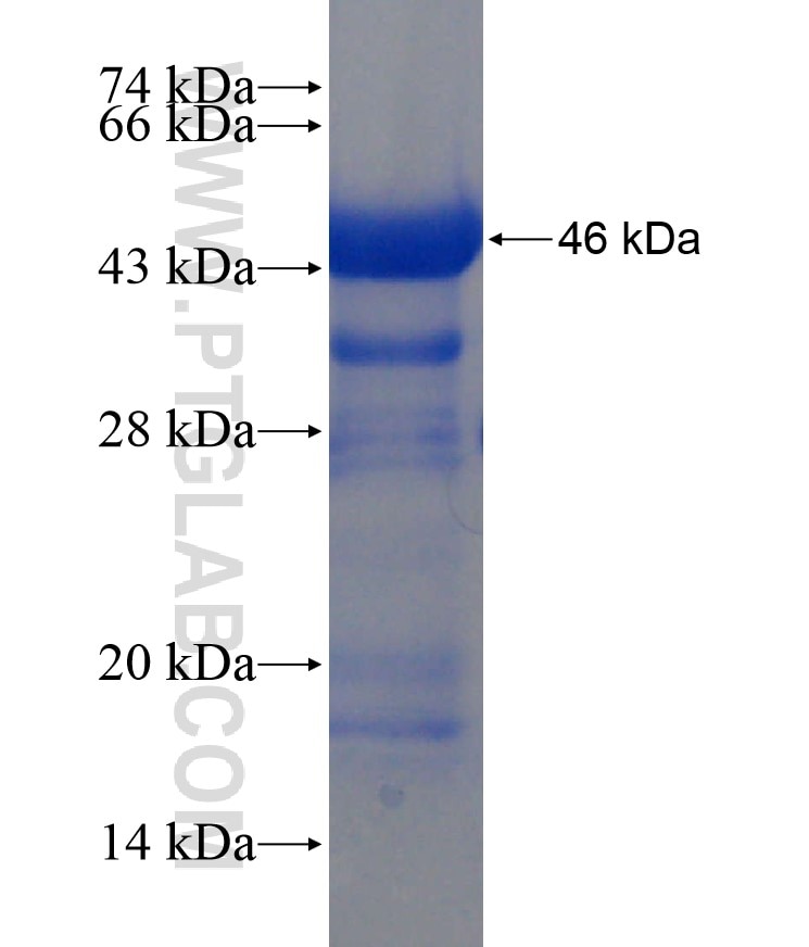 MSH2 fusion protein Ag17731 SDS-PAGE MSH2 fusion protein Ag17731 SDS-PAGE