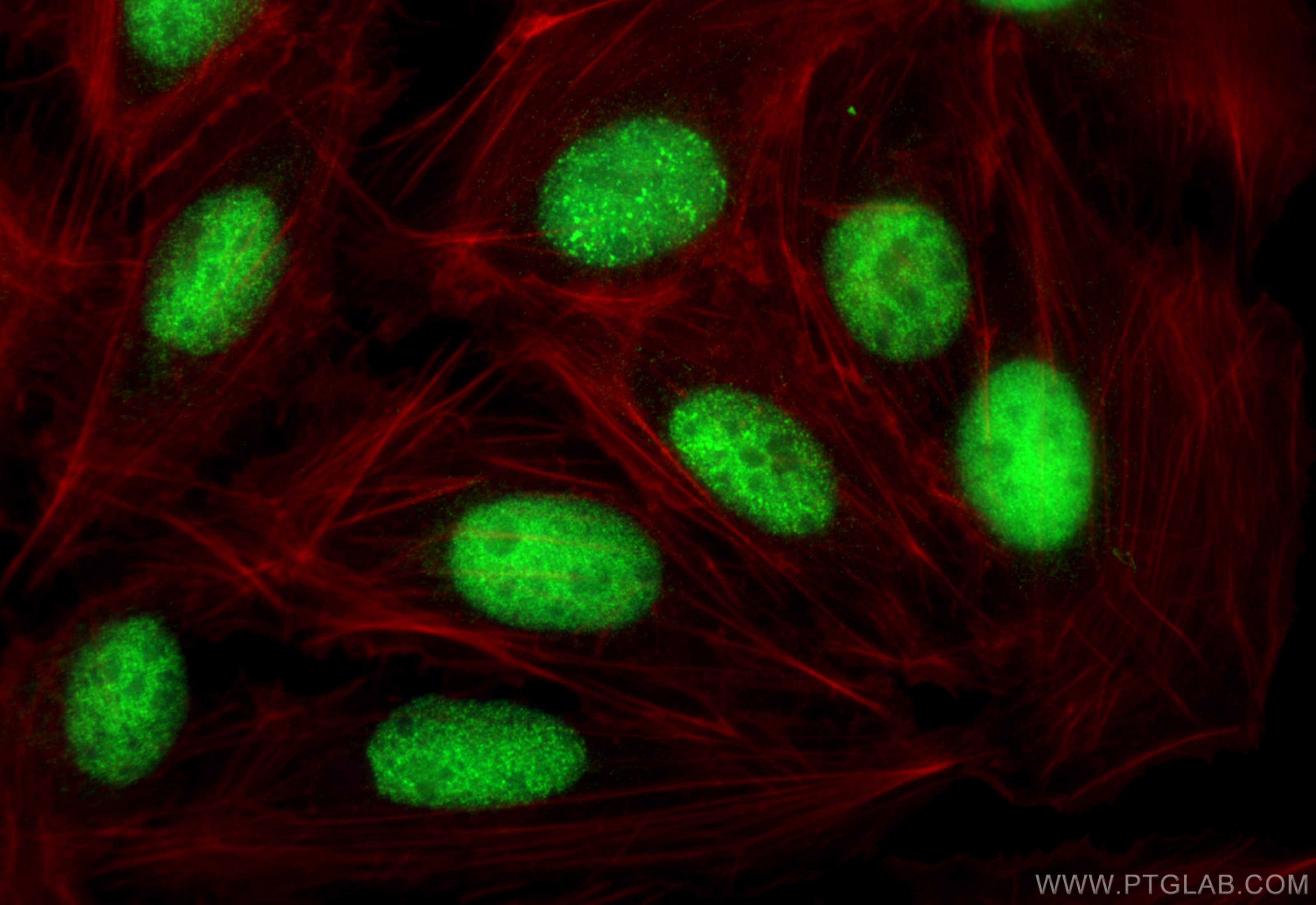 Immunofluorescence (IF) / fluorescent staining of U2OS cells using MSH3 Polyclonal antibody (22393-1-AP)