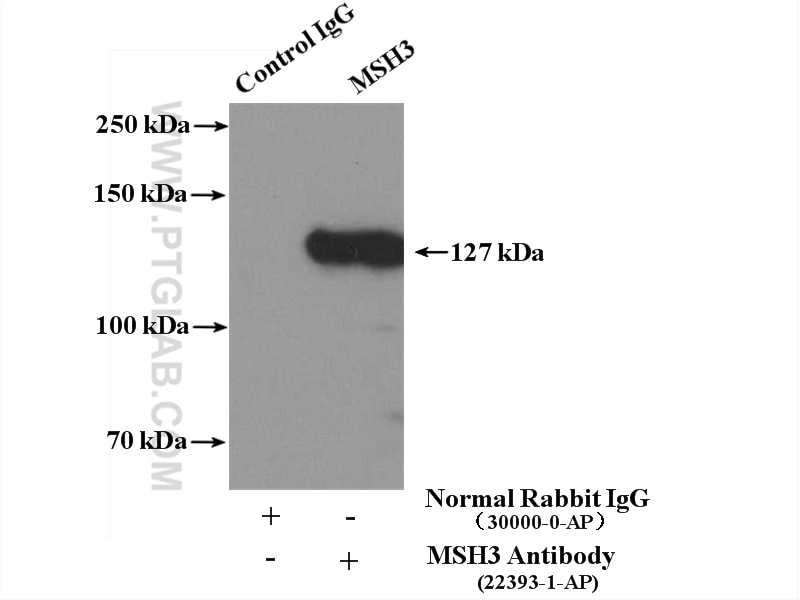 Immunoprecipitation (IP) experiment of HeLa cells using MSH3 Polyclonal antibody (22393-1-AP)