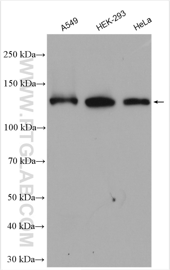 Western Blot (WB) analysis of various lysates using MSH3 Polyclonal antibody (22393-1-AP)