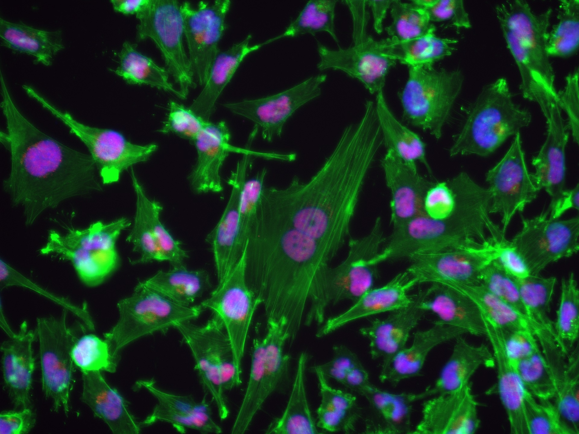 Immunofluorescence (IF) / fluorescent staining of U-251 cells using MSH3 Recombinant antibody (82845-3-RR)