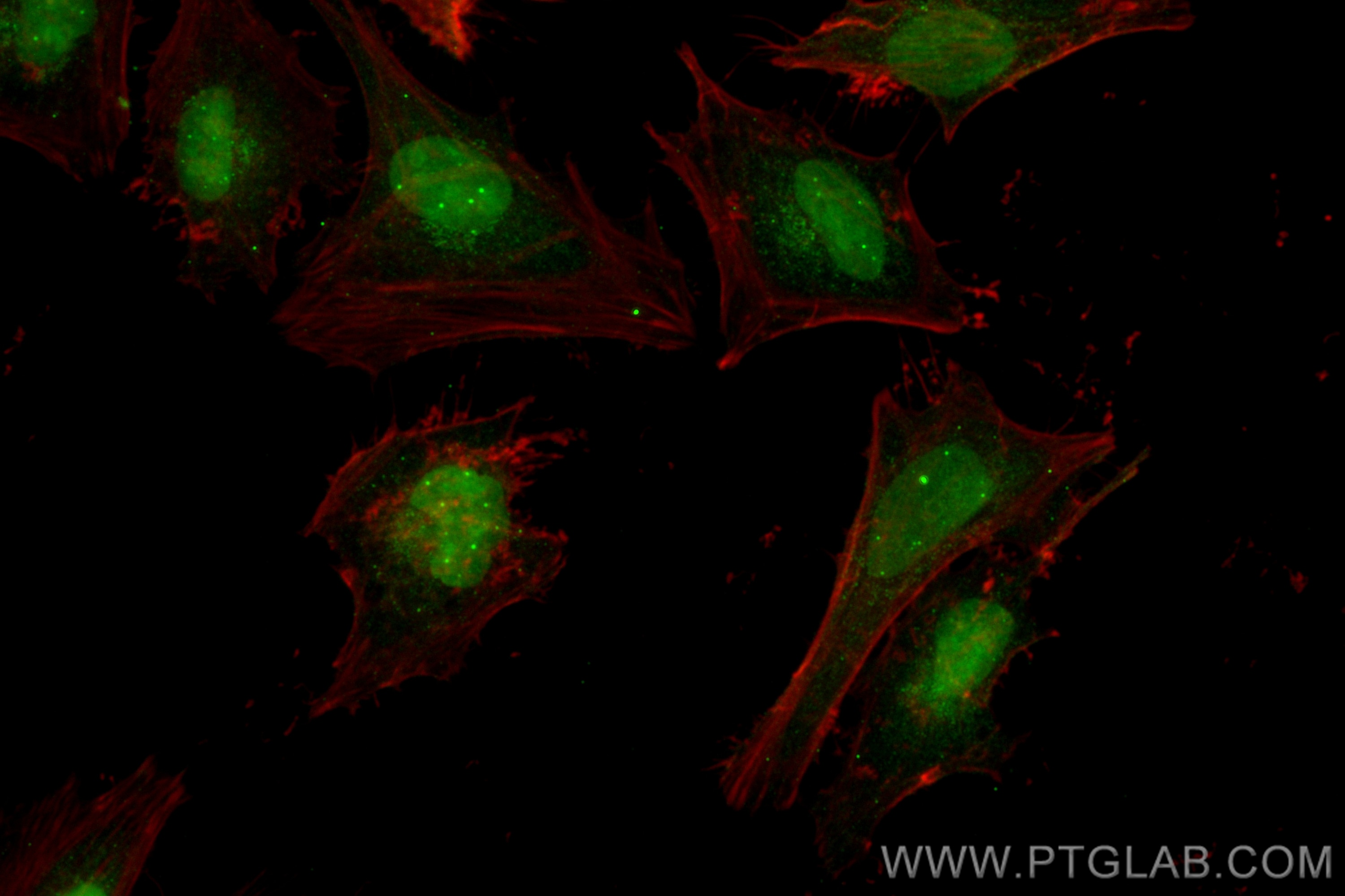 Immunofluorescence (IF) / fluorescent staining of HeLa cells using CoraLite® Plus 488-conjugated MSH3 Recombinant ant (CL488-82845-3)