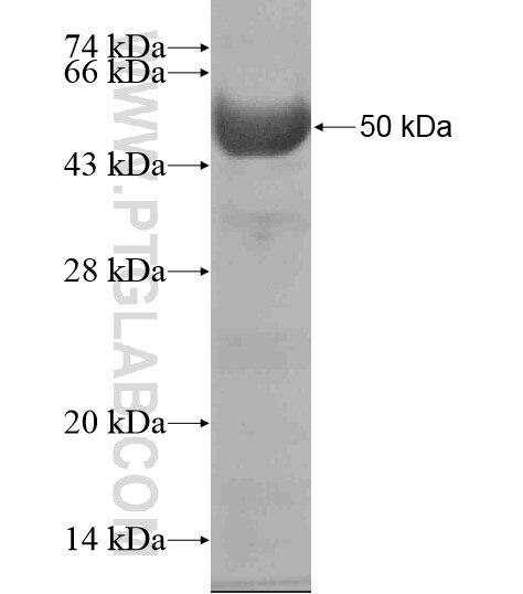 MSH3 fusion protein Ag19187 SDS-PAGE