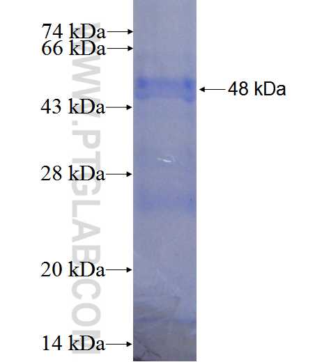 MSH5 fusion protein Ag0497 SDS-PAGE