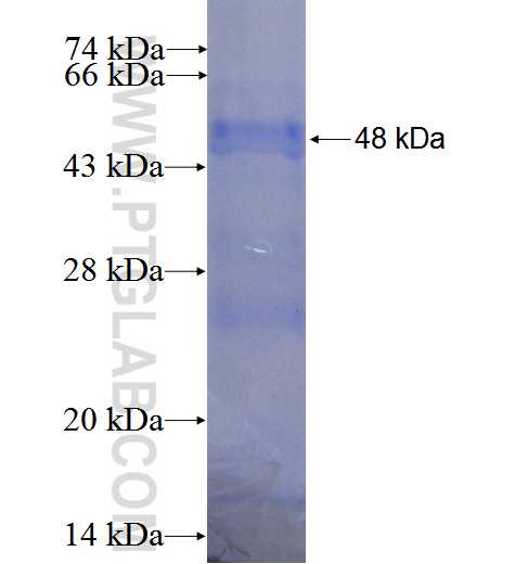 MSH5 fusion protein Ag0497 SDS-PAGE