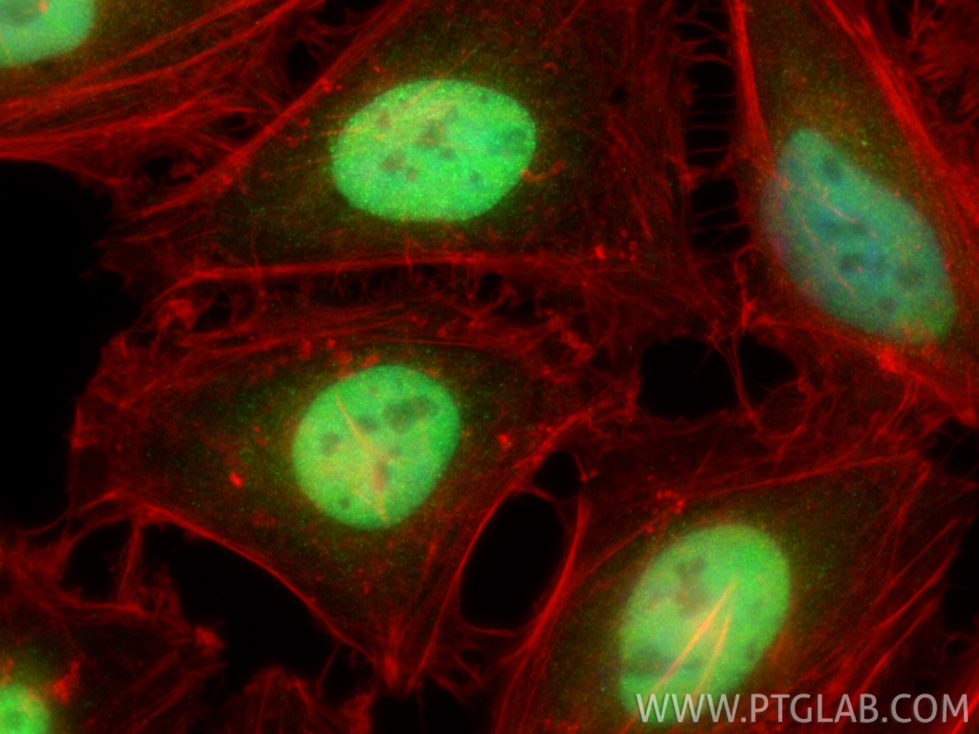Immunofluorescence (IF) / fluorescent staining of HeLa cells using MSH6 Polyclonal antibody (18120-1-AP)