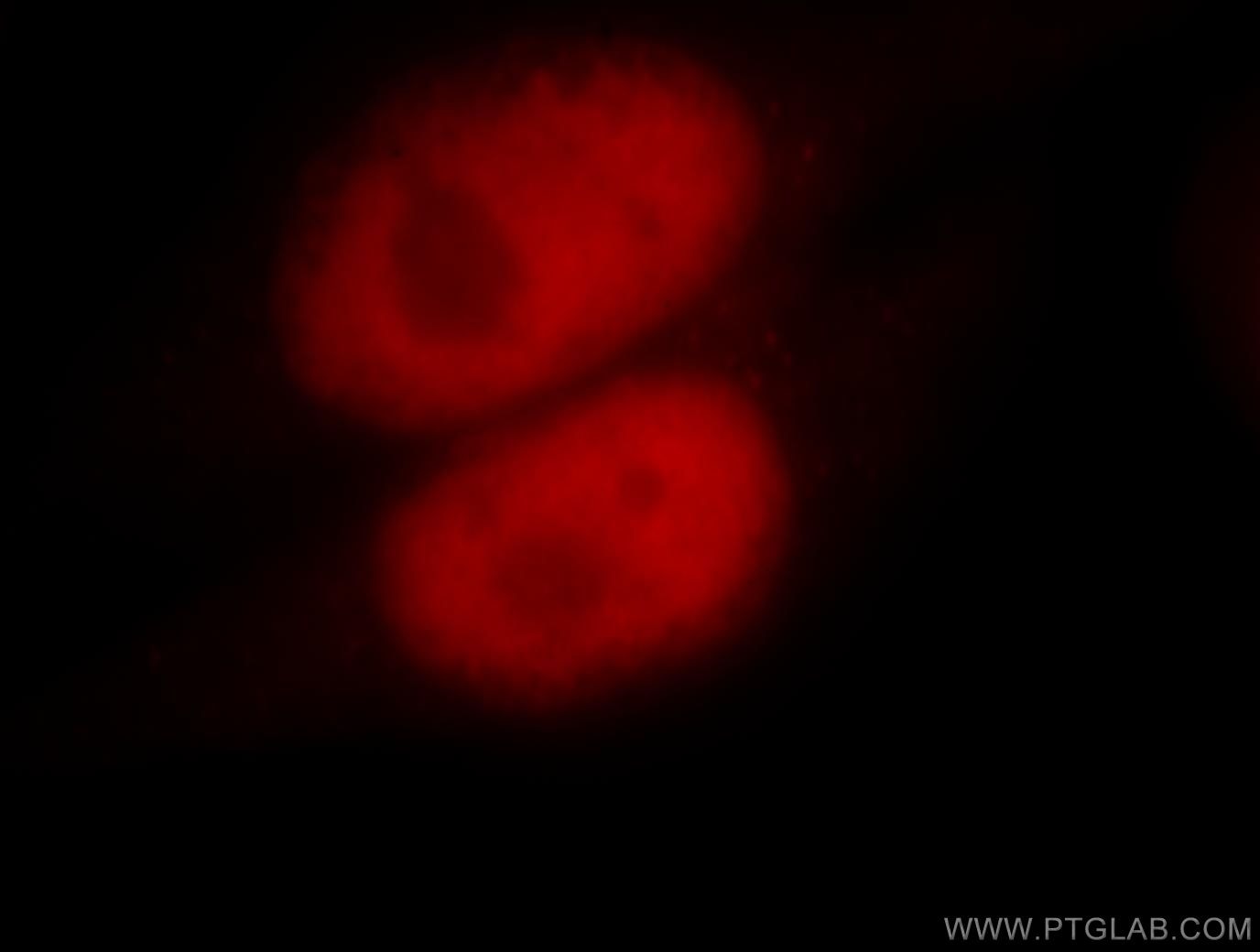 Immunofluorescence (IF) / fluorescent staining of HeLa cells using MSH6 Polyclonal antibody (18120-1-AP)