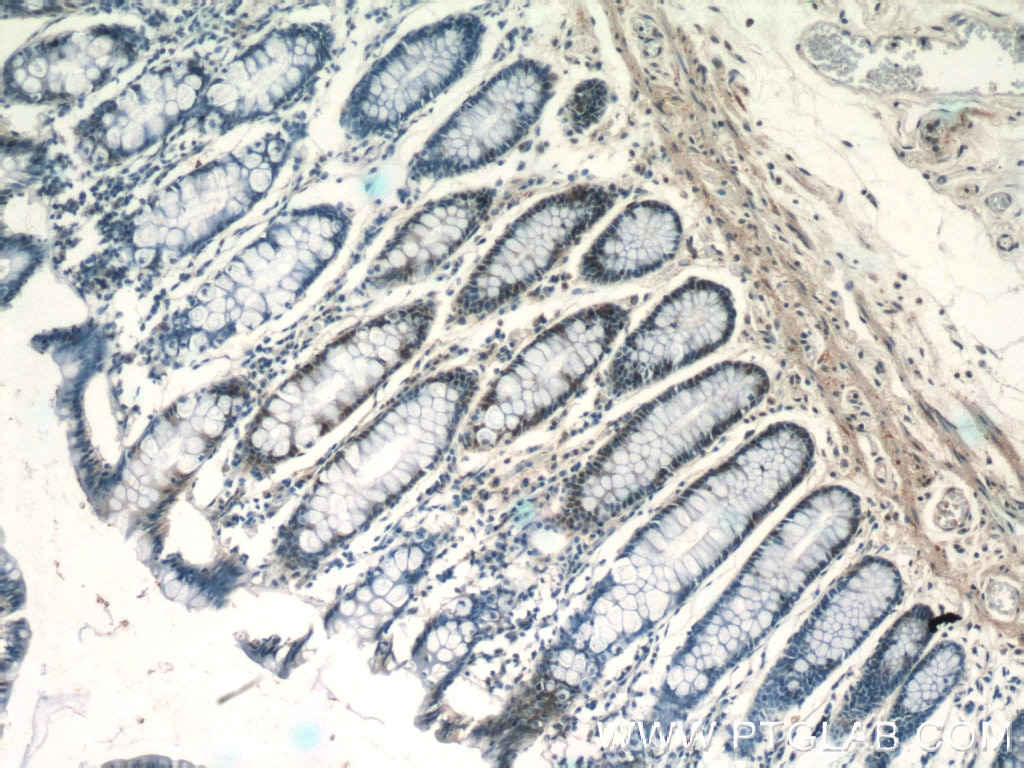 Immunohistochemistry (IHC) staining of human colon tissue using MSH6 Polyclonal antibody (18120-1-AP)