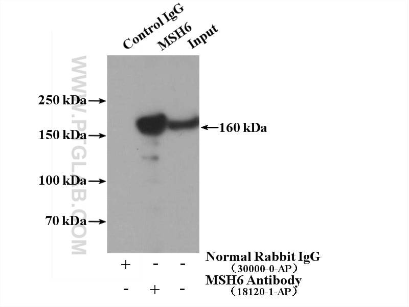 Immunoprecipitation (IP) experiment of HEK-293 cells using MSH6 Polyclonal antibody (18120-1-AP)