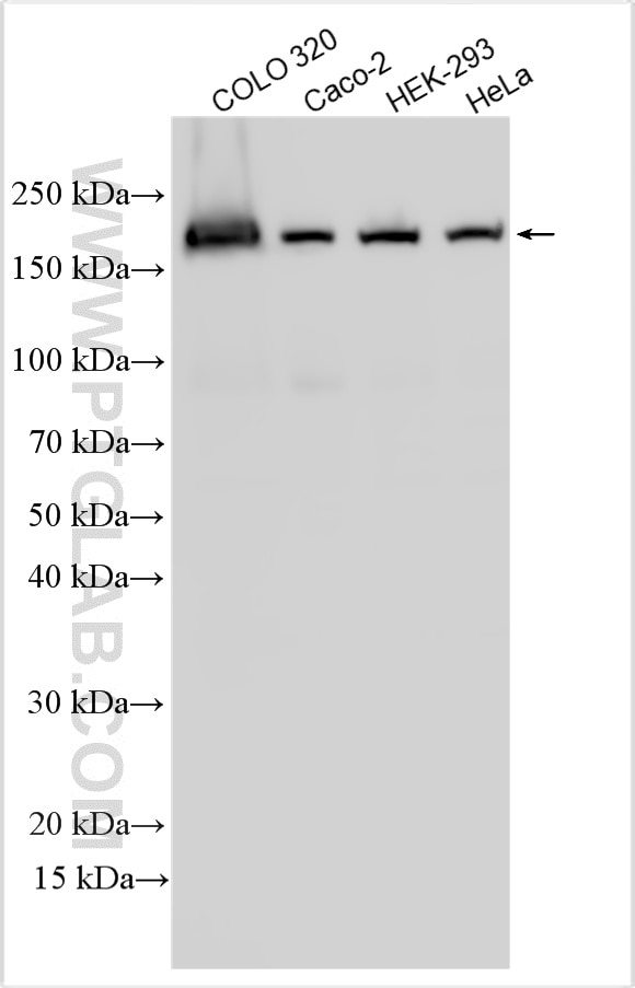 Western Blot (WB) analysis of various lysates using MSH6 Polyclonal antibody (18120-1-AP)