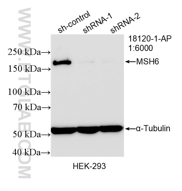 WB analysis of HEK-293 using 18120-1-AP Western Blot (WB) analysis of HEK-293 cells using MSH6 Polyclonal antibody (18120-1-AP)