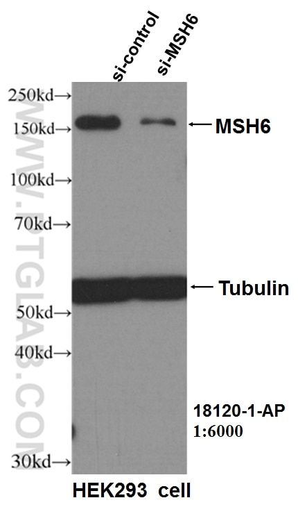 Western Blot (WB) analysis of HEK-293 cells using MSH6 Polyclonal antibody (18120-1-AP)